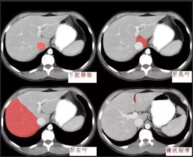 640.webp (3).jpg 640.webp (3).jpg