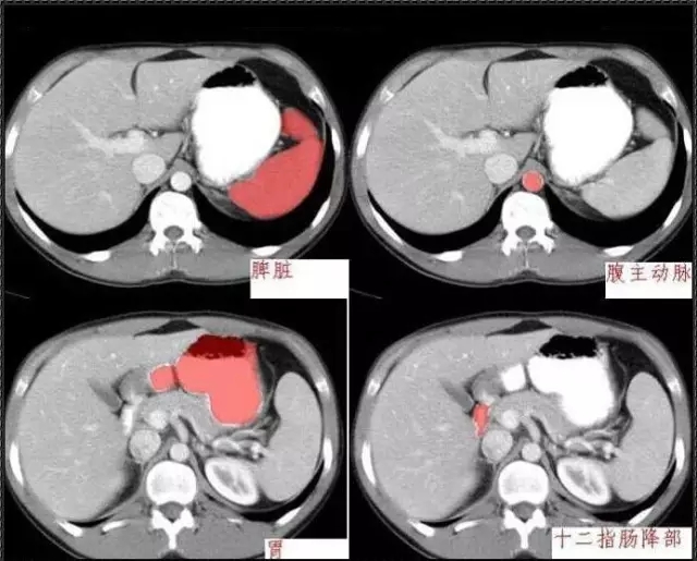 640.webp (4).jpg 640.webp (4).jpg