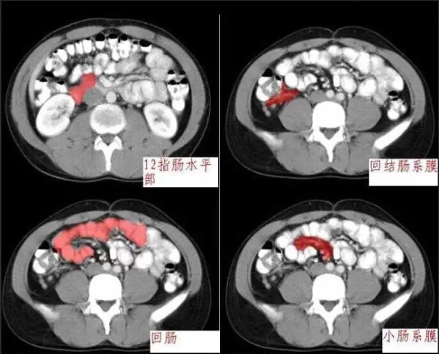 640.webp (12).jpg 640.webp (12).jpg