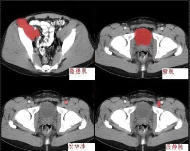 640.webp (17).jpg 640.webp (17).jpg