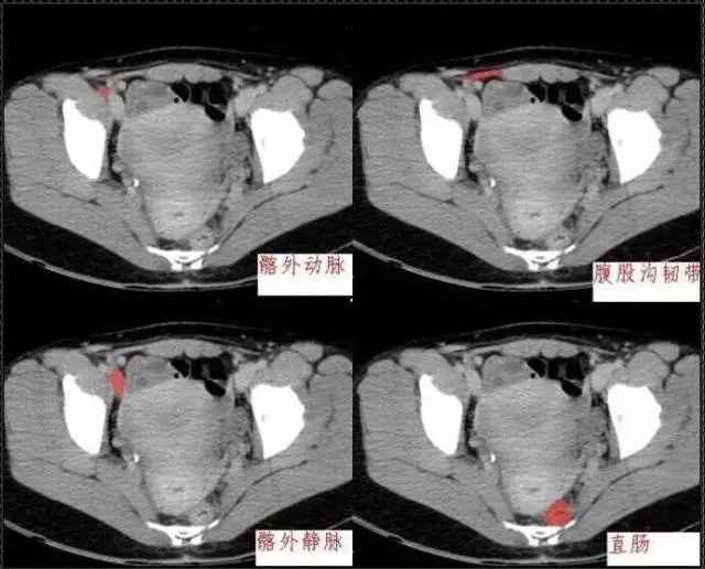 640.webp (19).jpg 640.webp (19).jpg