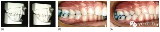 640.webp.jpg 640.webp.jpg