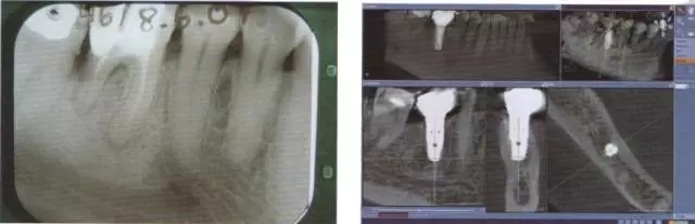 640.webp.jpg 640.webp.jpg