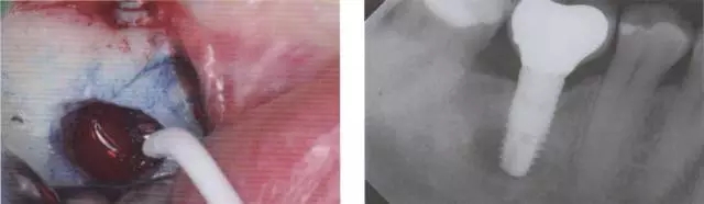 640.webp (2).jpg 640.webp (2).jpg