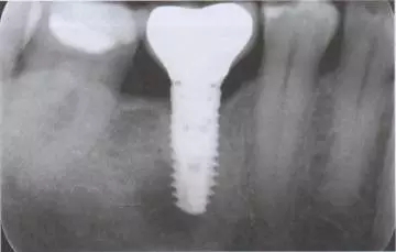 640.webp (3).jpg 640.webp (3).jpg