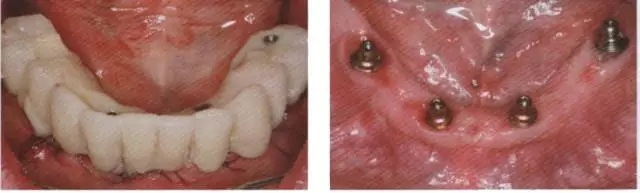 640.webp (6).jpg 640.webp (6).jpg