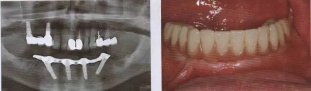 640.webp (7).jpg 640.webp (7).jpg