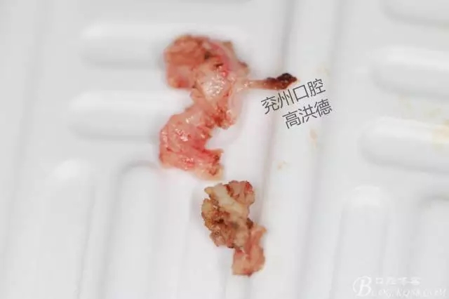 640.webp (11).jpg 640.webp (11).jpg