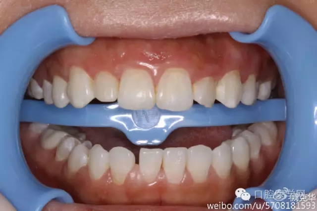 640.webp (3).jpg 640.webp (3).jpg