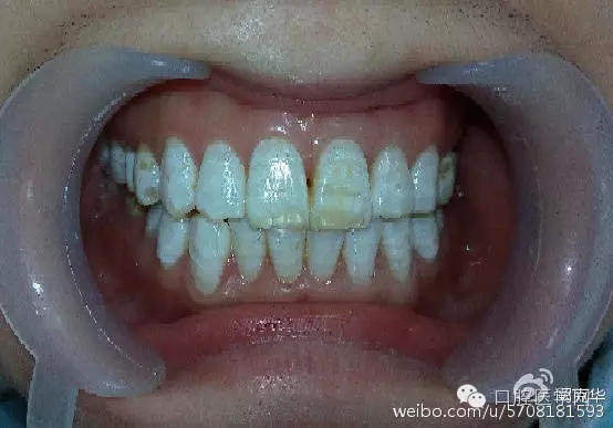 640.webp (4).jpg 640.webp (4).jpg