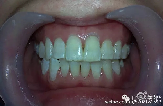 640.webp (5).jpg 640.webp (5).jpg