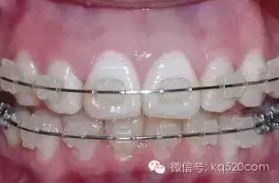 640.webp (1).jpg 640.webp (1).jpg