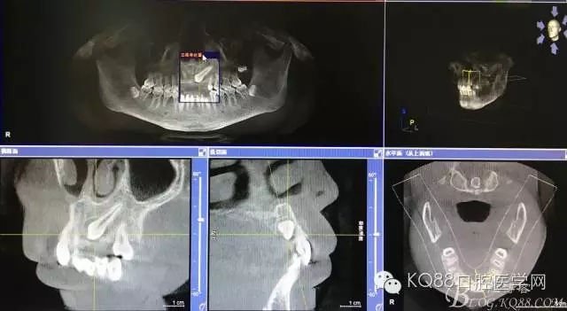 640.webp.jpg 640.webp.jpg