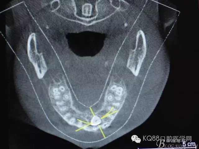 640.webp (4).jpg 640.webp (4).jpg