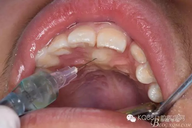 640.webp (9).jpg 640.webp (9).jpg