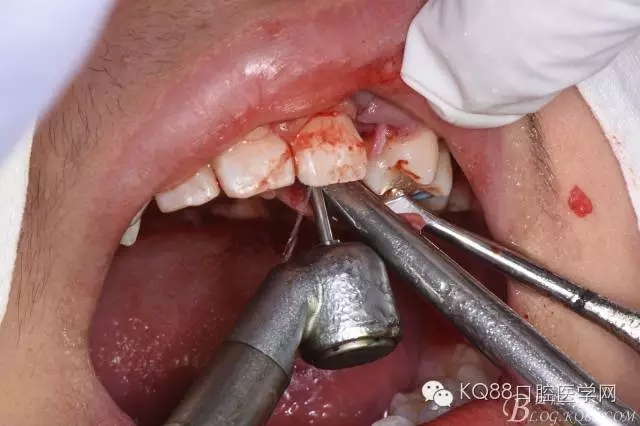 640.webp (13).jpg 640.webp (13).jpg