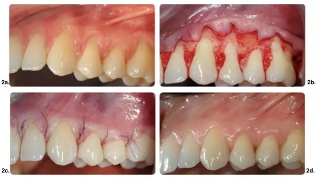 640.webp (20).jpg 640.webp (20).jpg