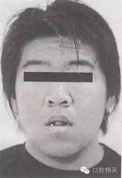 口腔醫(yī)學(xué)主治醫(yī)師筆試-精講強(qiáng)化-齲病牙體硬組織牙髓病和根尖周 口腔醫(yī)學(xué)主治醫(yī)師筆試-精講強(qiáng)化-齲病牙體硬組織牙髓病和根尖周