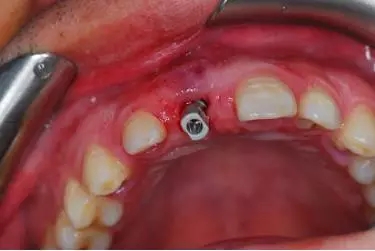 640.webp (2).jpg 640.webp (2).jpg