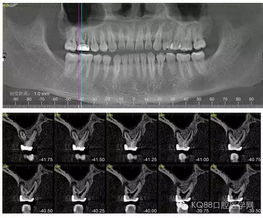 640.webp.jpg 640.webp.jpg