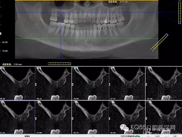 640.webp (3).jpg 640.webp (3).jpg