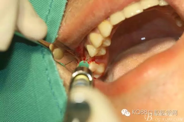 640.webp (6).jpg 640.webp (6).jpg