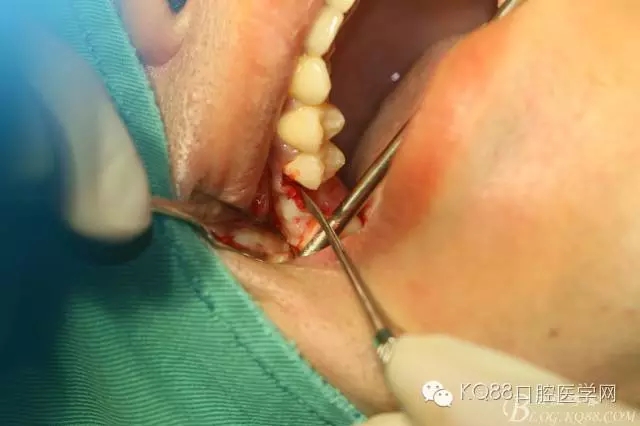 640.webp (9).jpg 640.webp (9).jpg