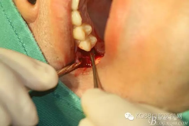 640.webp (11).jpg 640.webp (11).jpg