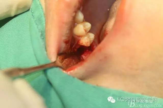 640.webp (13).jpg 640.webp (13).jpg