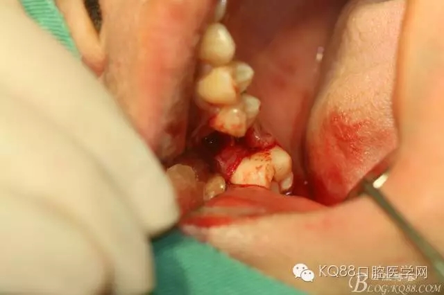 640.webp (17).jpg 640.webp (17).jpg