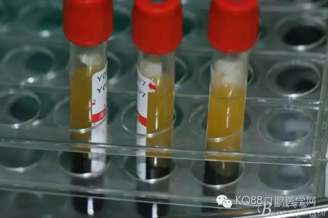 640.webp (18).jpg 640.webp (18).jpg