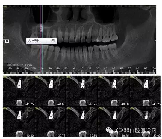 640.webp (33).jpg 640.webp (33).jpg