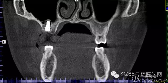 640.webp (35).jpg 640.webp (35).jpg