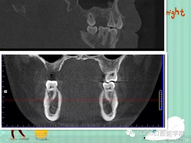 640.webp (36).jpg 640.webp (36).jpg