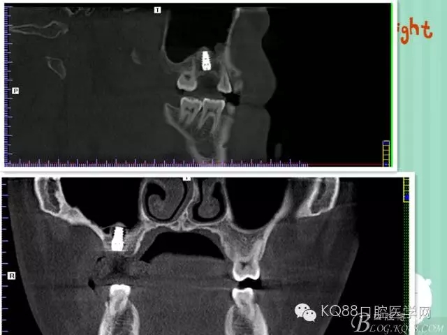 640.webp (37).jpg 640.webp (37).jpg