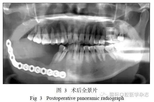 640.webp (11).jpg 640.webp (11).jpg