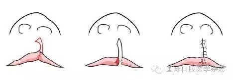 640.webp.jpg 640.webp.jpg