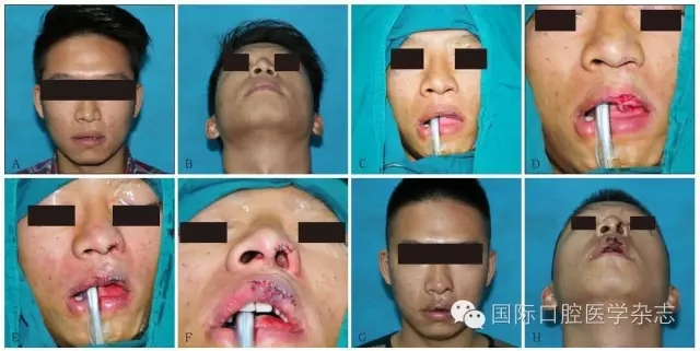 640.webp (1).jpg 640.webp (1).jpg