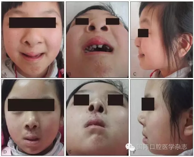 640.webp (4).jpg 640.webp (4).jpg