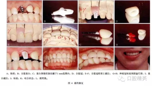 640.webp (4).jpg 640.webp (4).jpg