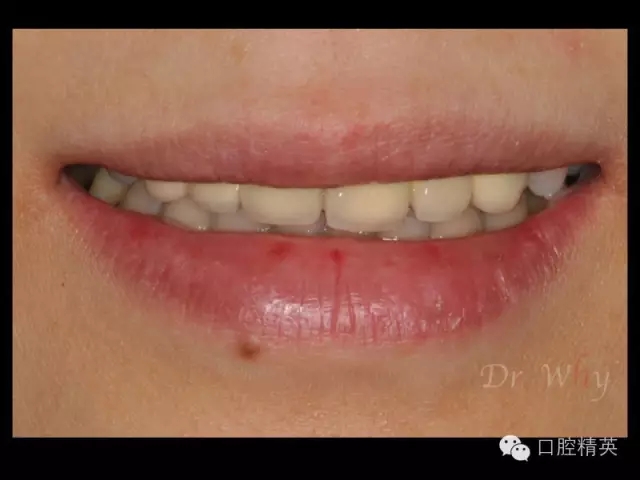 640.webp (2).jpg 640.webp (2).jpg