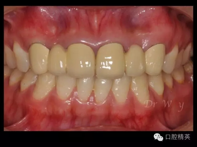 640.webp (3).jpg 640.webp (3).jpg