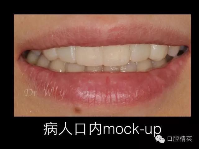 640.webp (10).jpg 640.webp (10).jpg