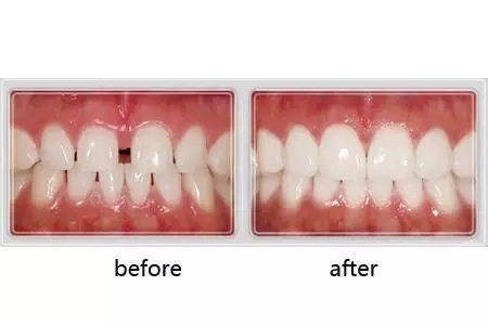 640.webp.jpg 640.webp.jpg