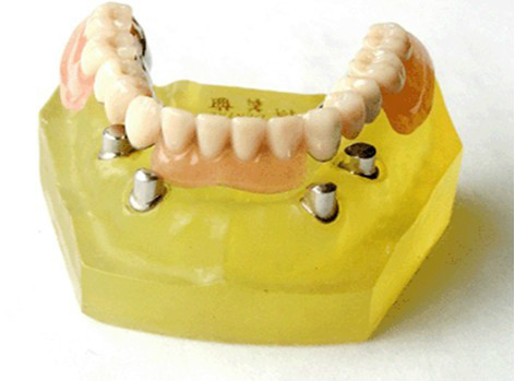 精密附件種類圖譜 精密附件種類圖譜