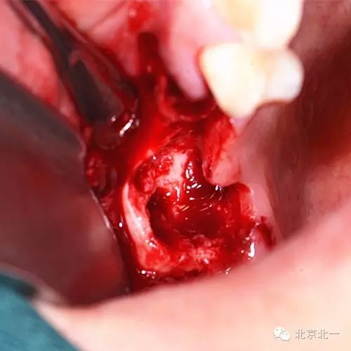 640.webp (4).jpg 640.webp (4).jpg