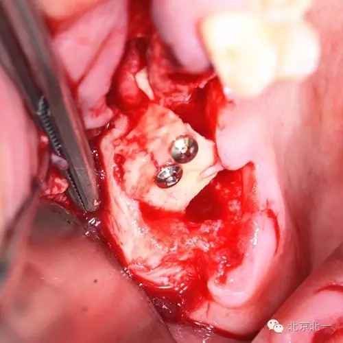 640.webp (6).jpg 640.webp (6).jpg