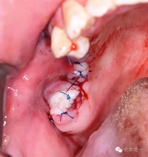 640.webp (9).jpg 640.webp (9).jpg