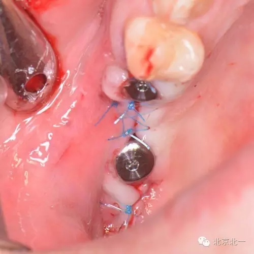 640.webp (16).jpg 640.webp (16).jpg