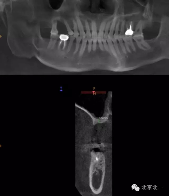 640.webp (17).jpg 640.webp (17).jpg